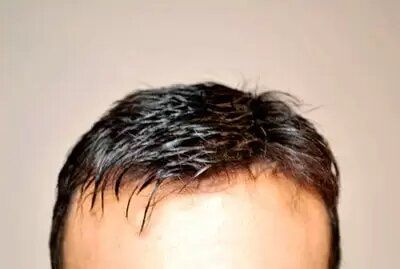 A close up of a man 's hair against a white background.