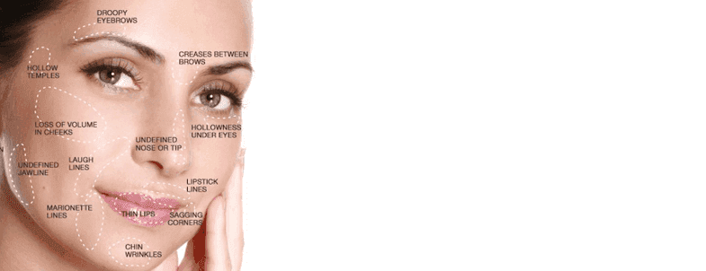 Injectables - Botox | Voluma |Kybella