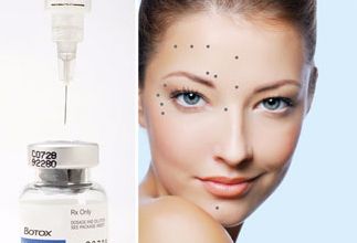 Botox in Lynnfield, MA or E. Providence RI