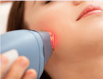 Laser Hair Removal