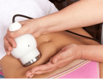 Skin Tightening: Arms, Abdomen, Legs