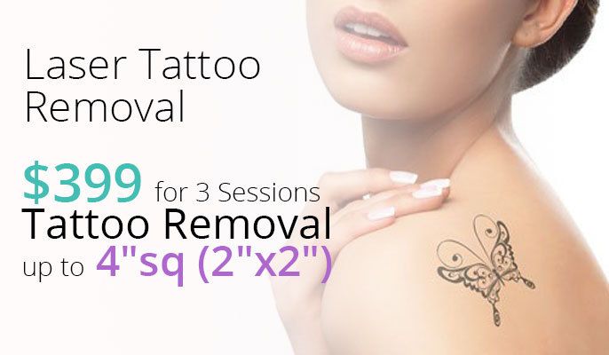 Laser Tattoo Removal - New Patient Special