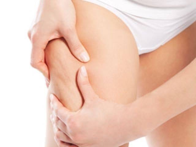 Cellulite Treatment