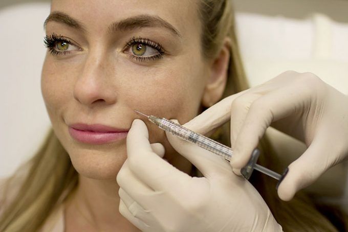 Radiesse for Laugh lines