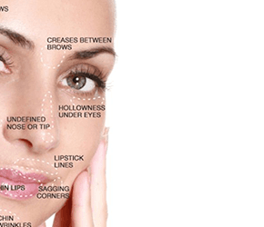 Injectables - Botox & Fillers