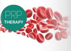 PRP Plasma for Hair Loss  Near Me