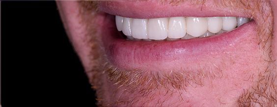 Close-up of a smiling person's white teeth and pink lips.