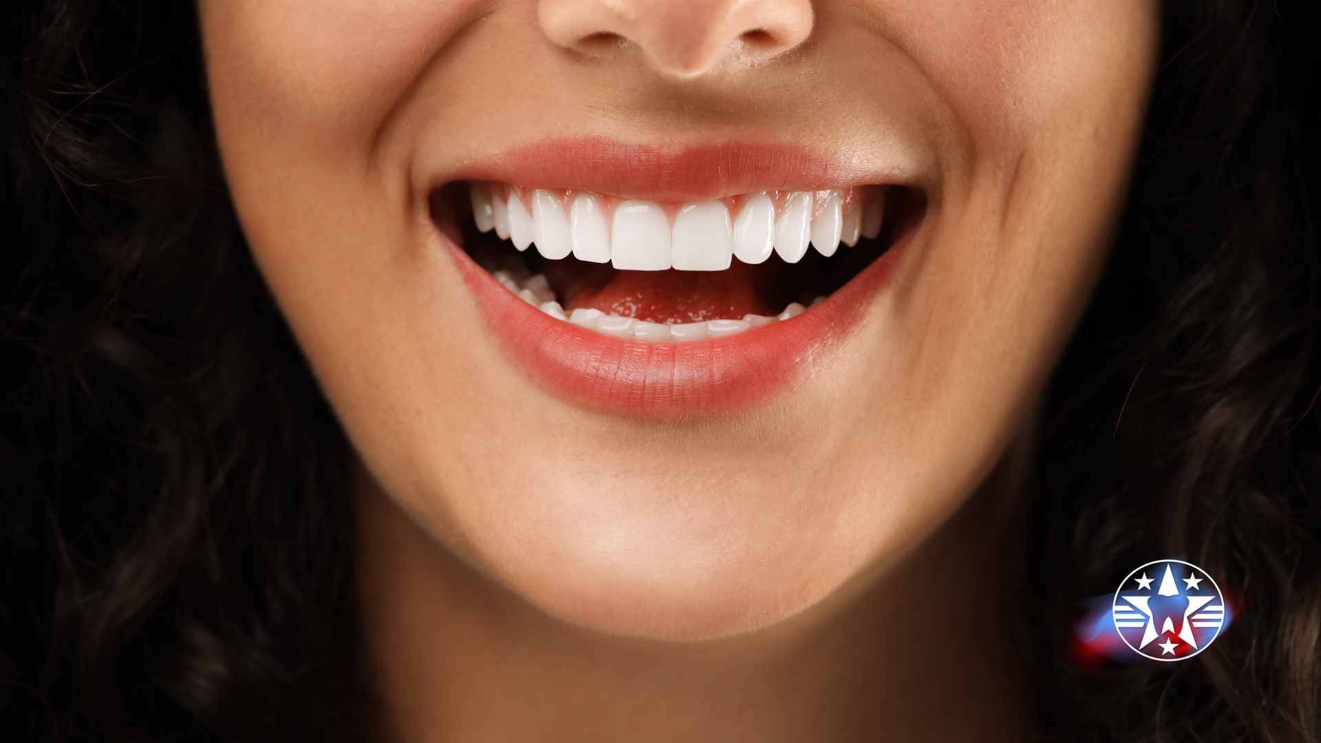 Close-up of a smiling mouth with white teeth, pink gums, and full lips.