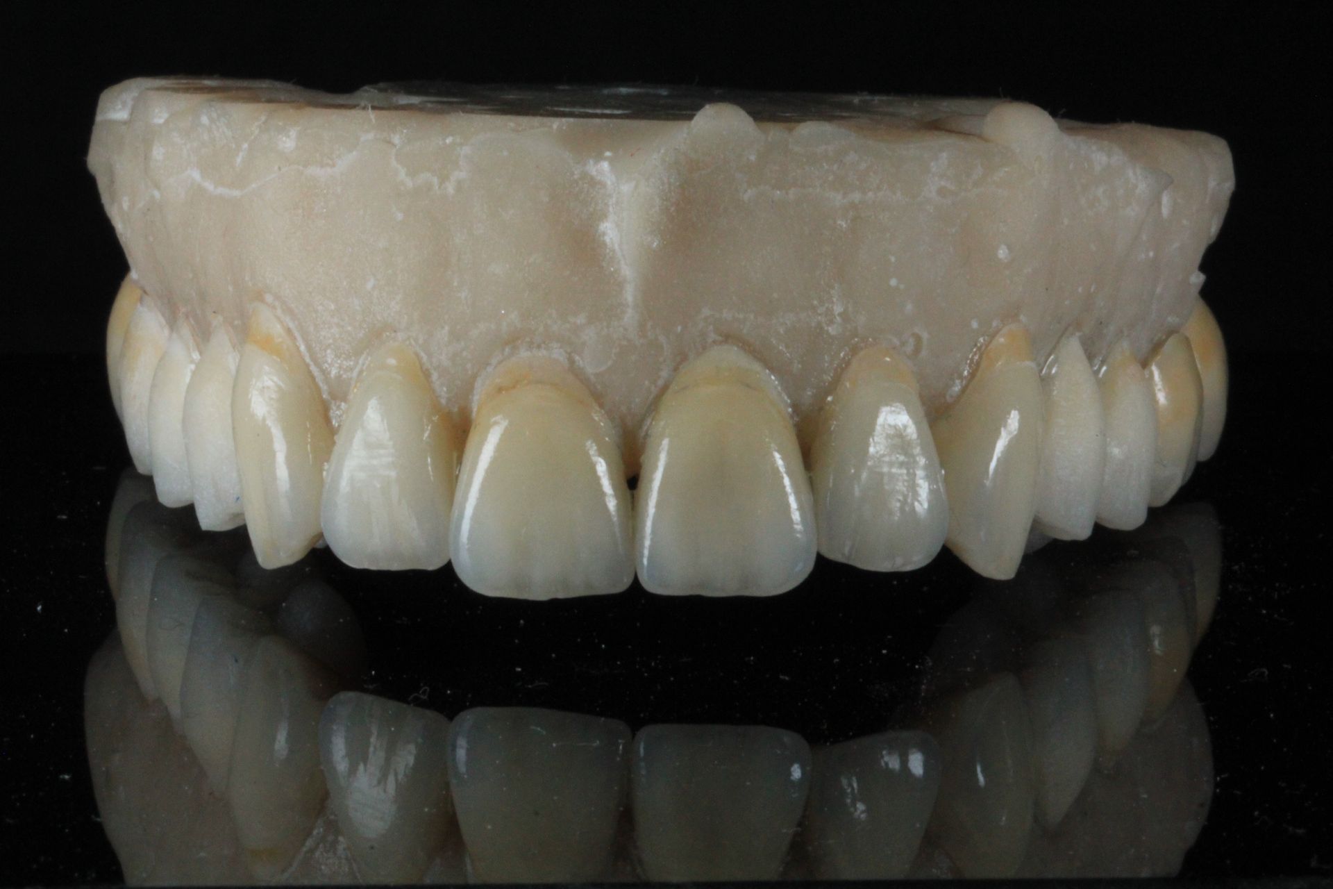 A close up of a model of teeth on a black background.