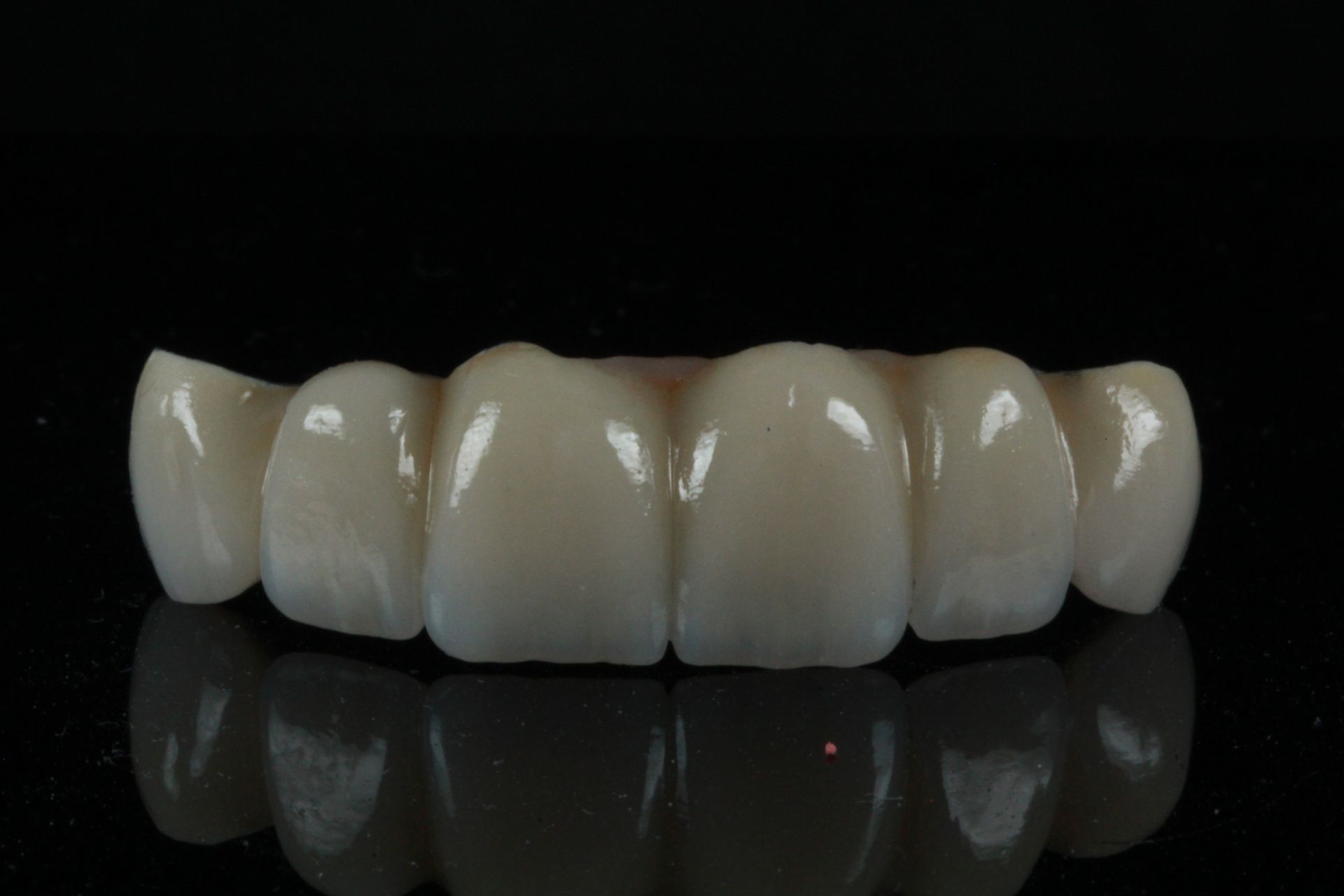 Three dental crowns are sitting on top of each other on a black background.