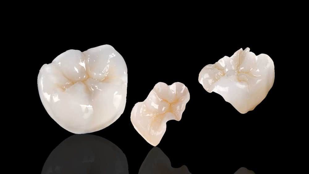 Three white teeth are sitting on top of each other on a black surface.