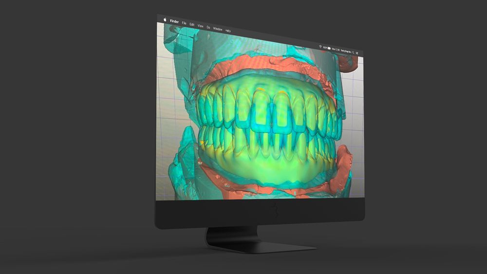 A computer monitor shows a 3d model of a person 's teeth.
