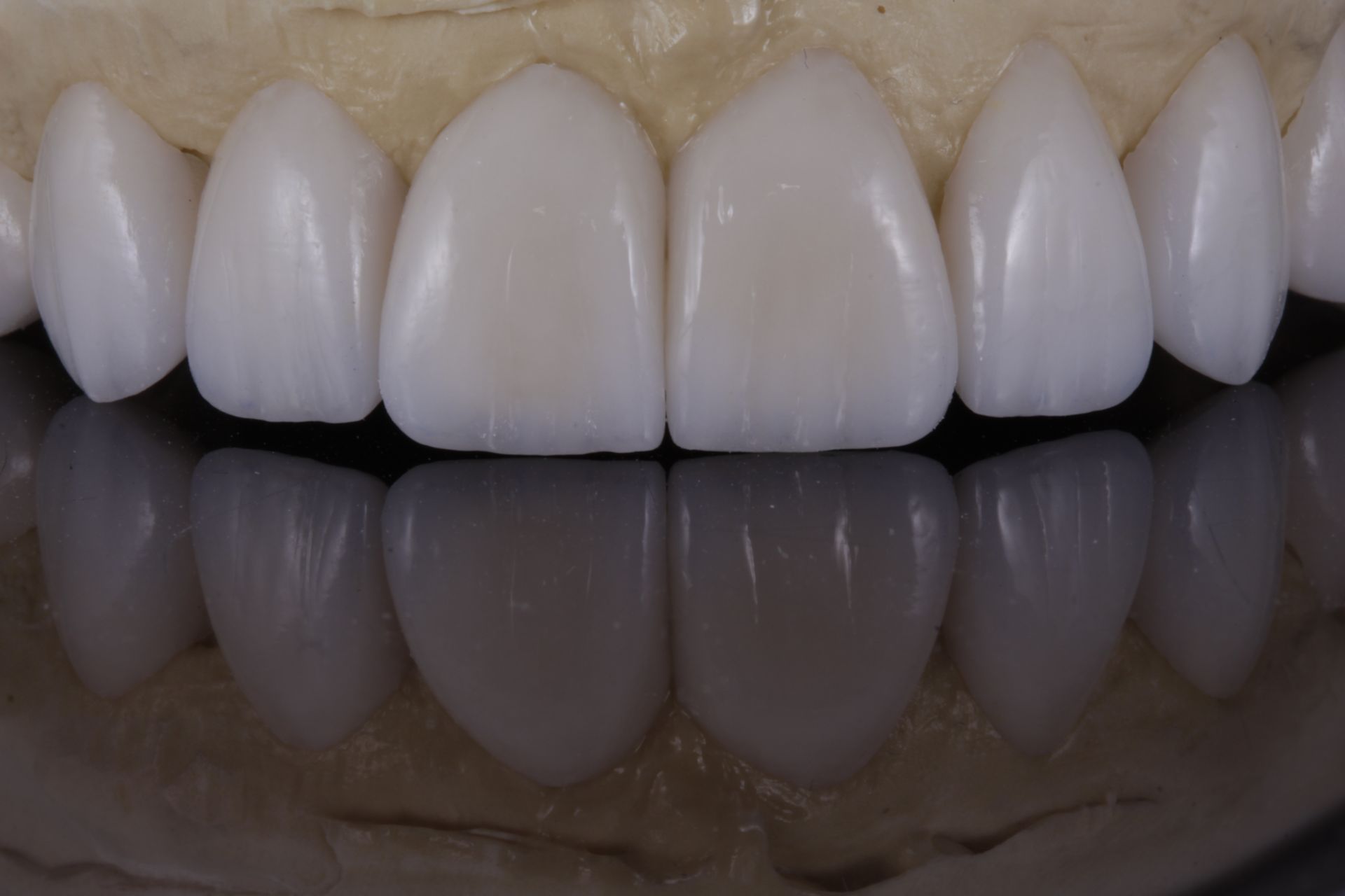 A close up of a person 's teeth on a black background.