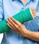 Broken Arm - Personal Injury Claims