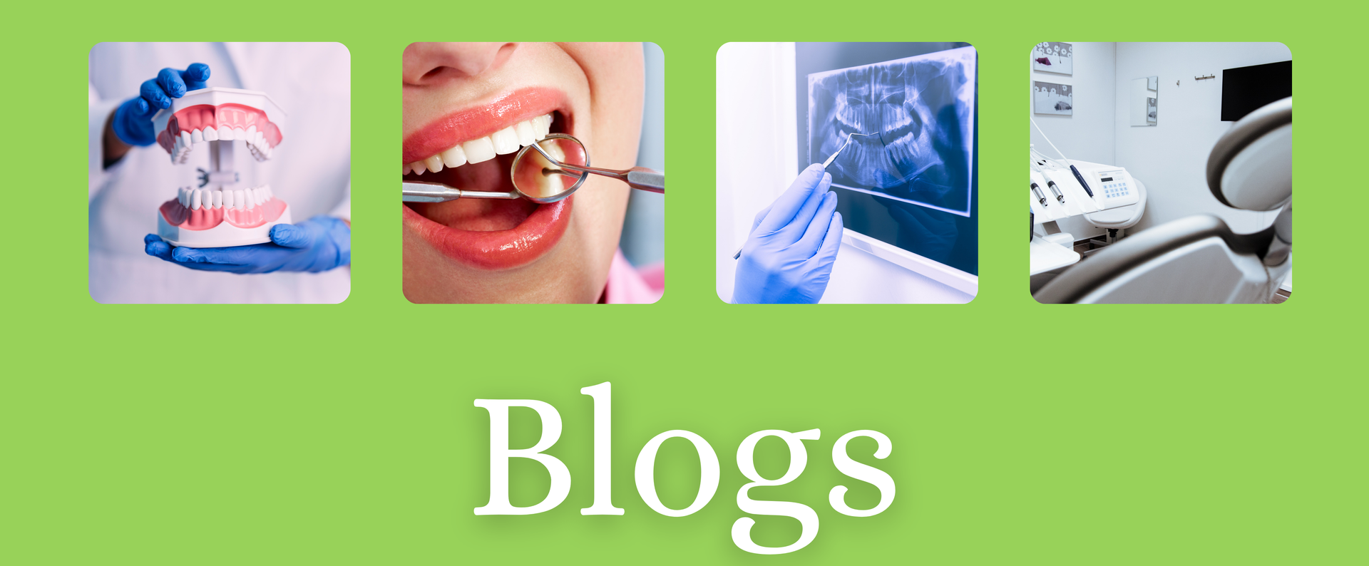 Dental blogs banner with four square images: dentist holding a model, patient's mouth, dental X-ray, and dental chair.