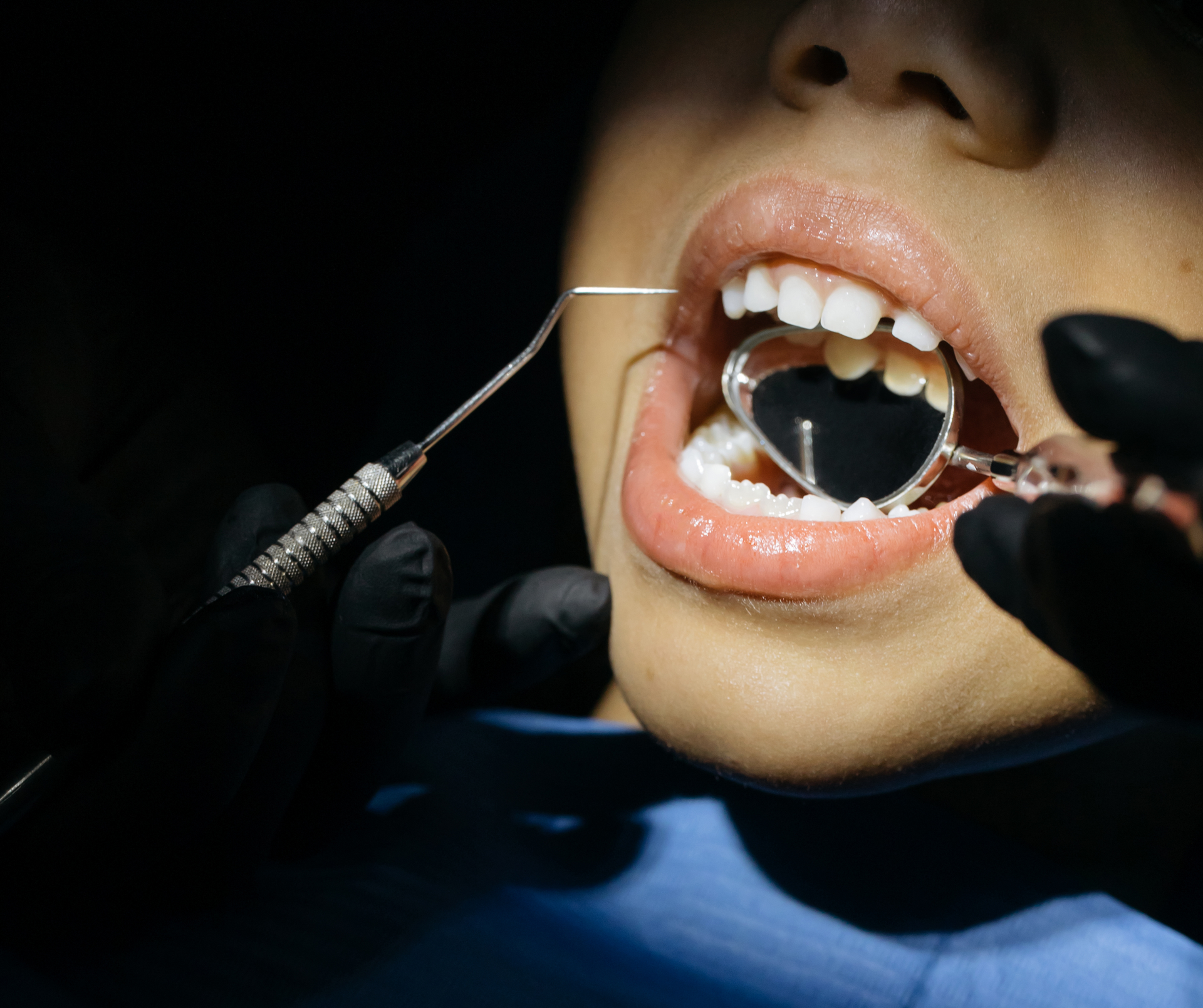 Dentist examining a patient's teeth with a dental mirror and probe in a dental office.