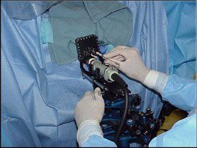 Prostate Seed Implants