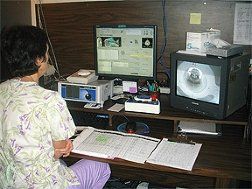 Tomotherapy Machines