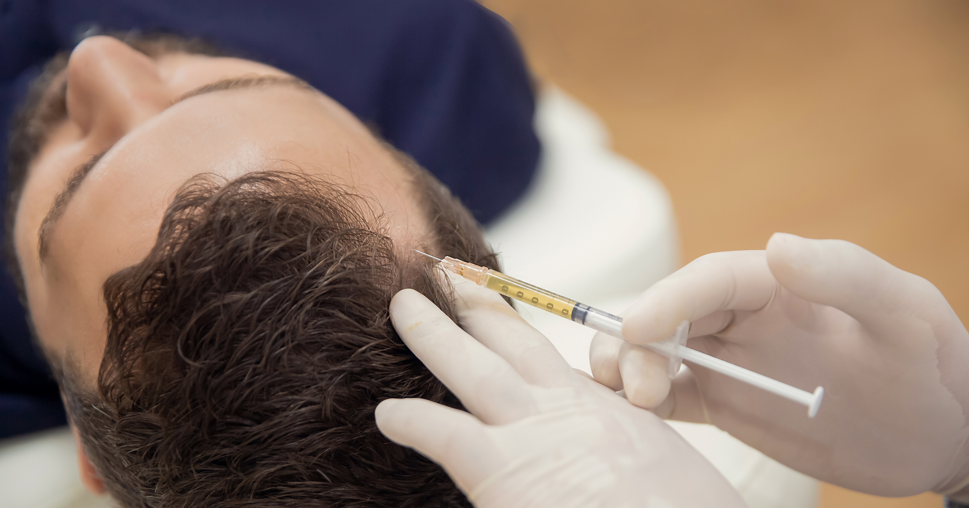 Harnessing the Power of Platelet-Rich Plasma for Fuller, Thicker Hair at Kellogg Clinic