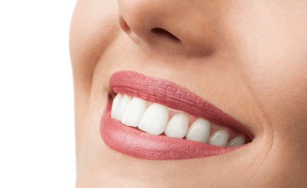 Chilliwack Cosmetic Dental Services