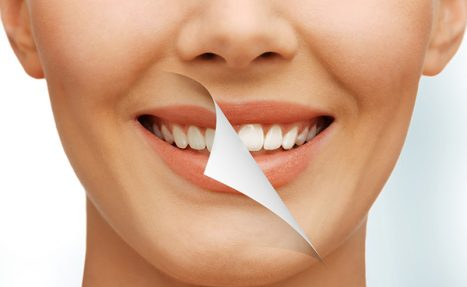 Chilliwack Cosmetic Dental Services