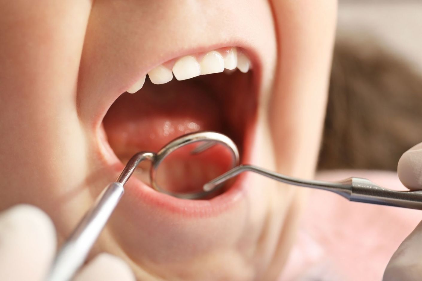 un bambino durante una visita odontoiatrica