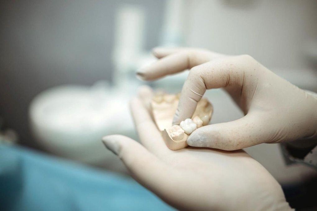 Un dentista tiene tra le mani un modello dei denti di una persona.