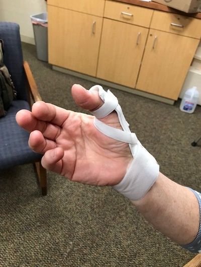 Wrist — Splint on an Injured Wrist in Homewood, IL