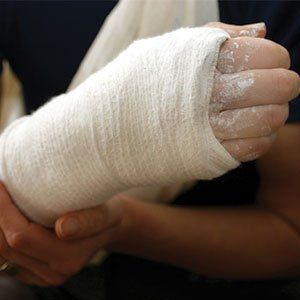 Hand Rehabilitation — Hand with White Plaster Cast in Homewood, IL