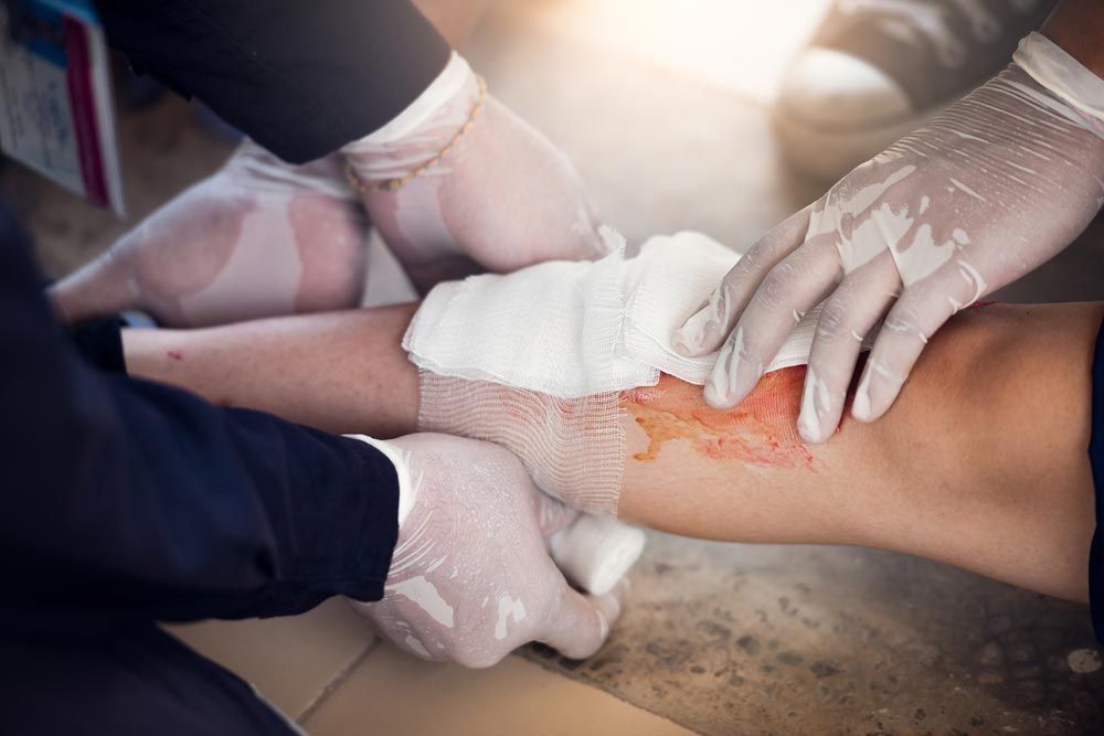Paramedic Applying Bandage to Patient's Leg — First Aid Industrial Medical In Newcastle, NSW
