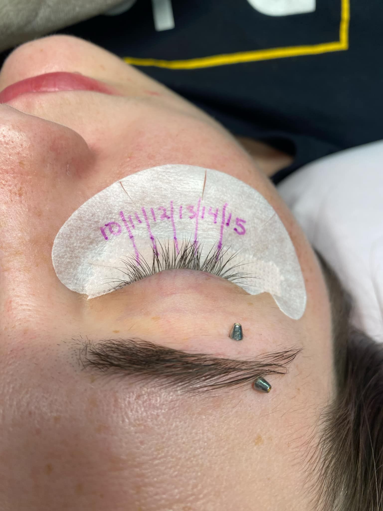 A close up of a person 's eye with a patch on it.