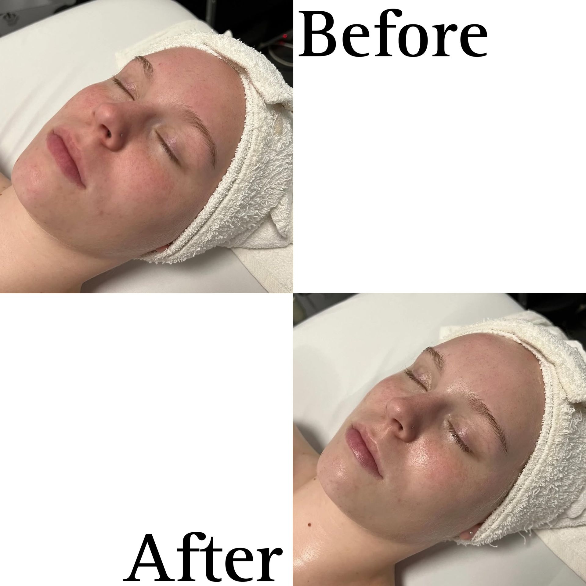 A before and after picture of a woman with a towel on her head