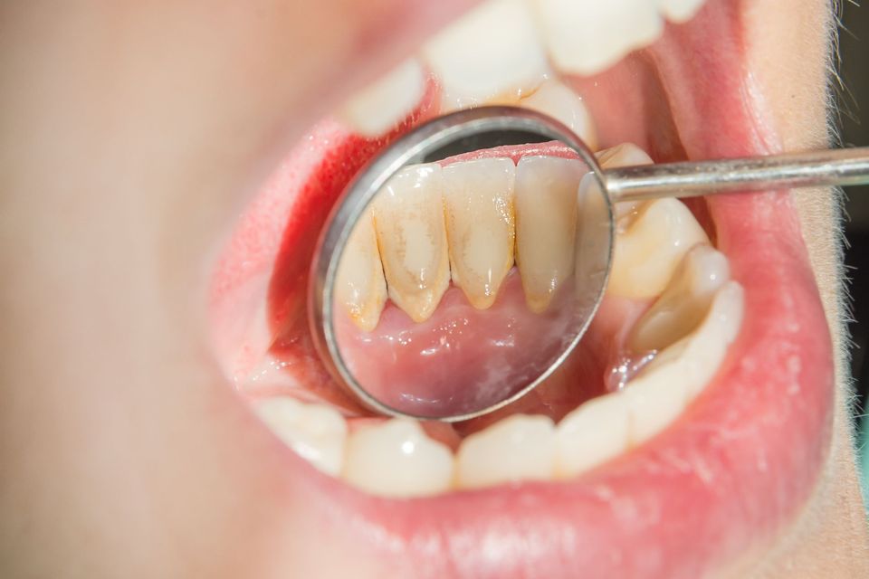 dentista durante un trattamento su un paziente