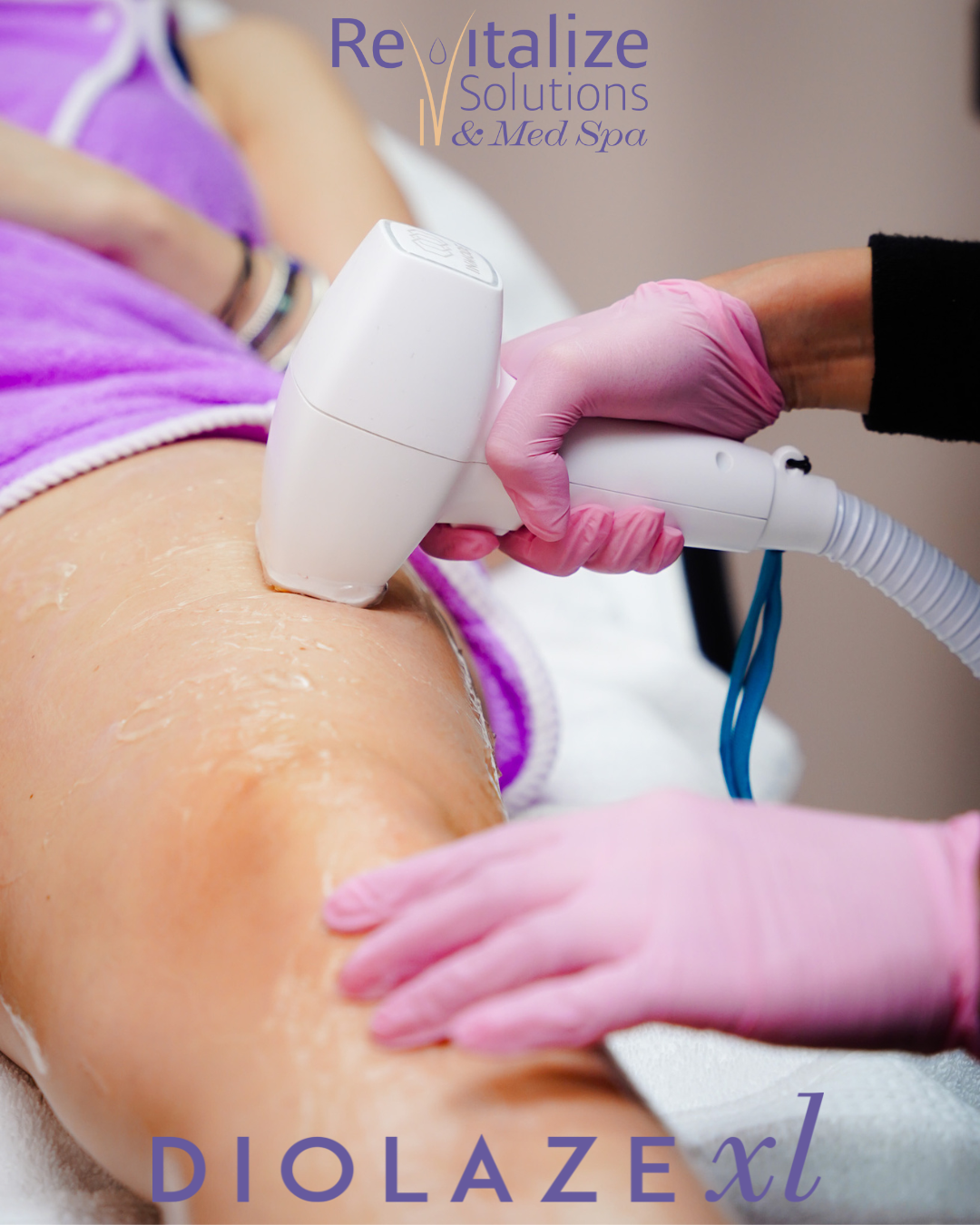 Laser hair removal treatment on a leg with a white device and pink-gloved hands