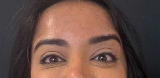 Close-up of a person’s eyes and forehead, with dark hair framing the face and raised eyebrows