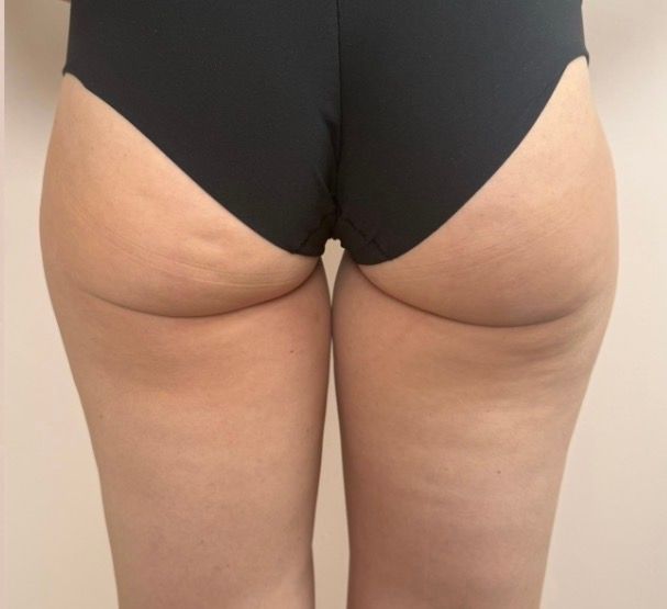Close-up of lower back and buttocks in black underwear against a plain background