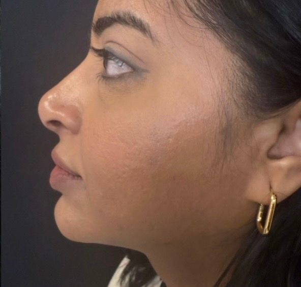 Profile view of a woman with dark hair, wearing a gold hoop earring, against a dark background