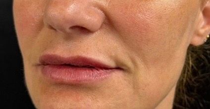 Close-up of a person’s lower face with a neutral expression and slightly parted lips