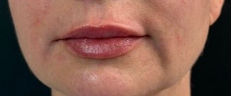 Close-up of a person’s lips and lower face with neutral expression on a dark background