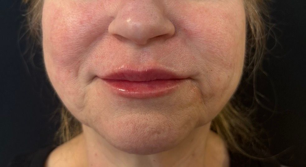 Close-up of a person’s lower face with glossy pink lips and a neutral expression.