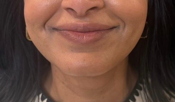 Close-up of a smiling mouth and lower face with natural makeup and dark hair.