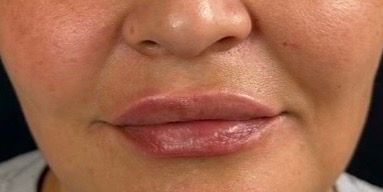 Close-up of a person’s mouth with glossy pink lipstick and a neutral expression