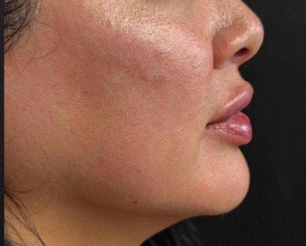 Side profile of a person’s face with visible cheek and jawline swelling or redness against a dark background