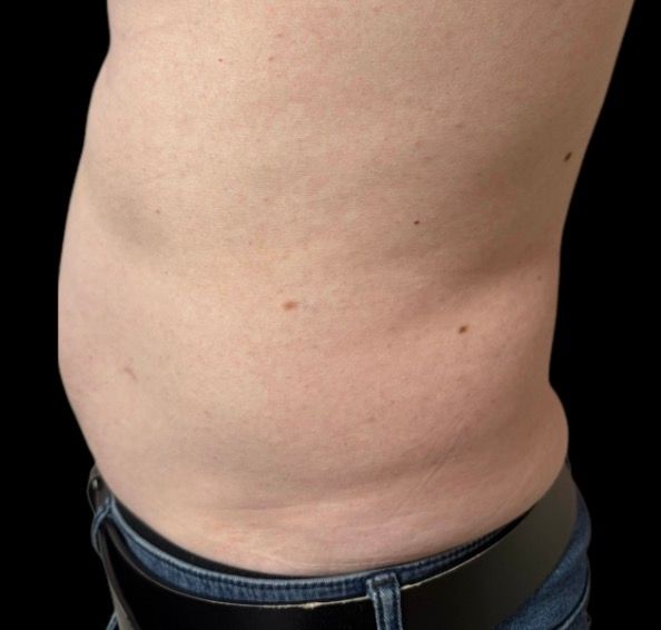 Side view of a bare midsection with visible belly and jeans waistband