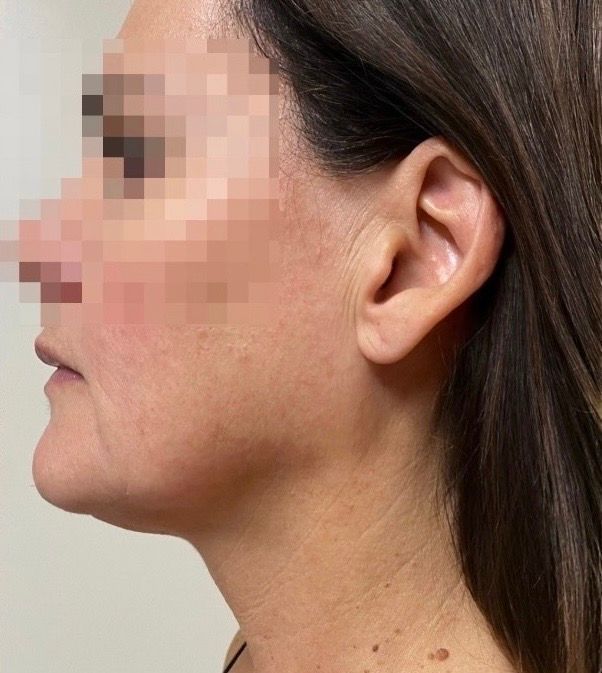 Side profile of a woman’s face with a blurred eye area against a plain background