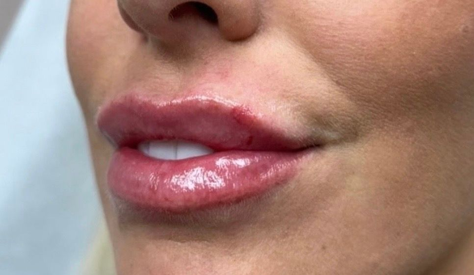 Close-up of glossy pink lips and lower face with gold earrings