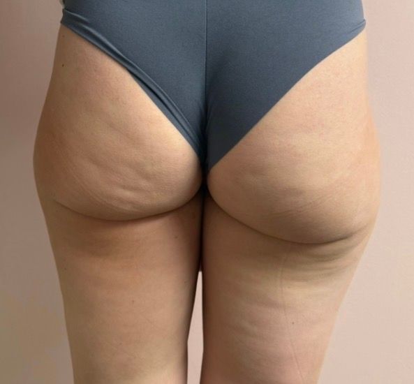 Back view of a person wearing dark blue underwear, showing the lower back and hips