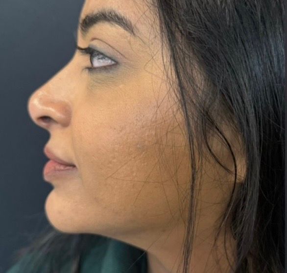 Side profile of a woman with dark hair against a plain gray background