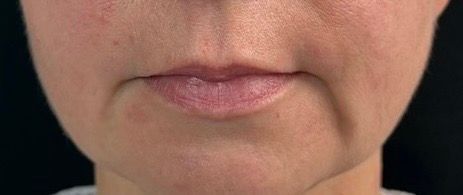 Close-up of a person’s mouth and chin with lips gently pressed together