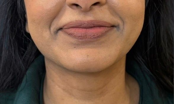 Close-up of a smiling person’s lower face and neck against a dark background